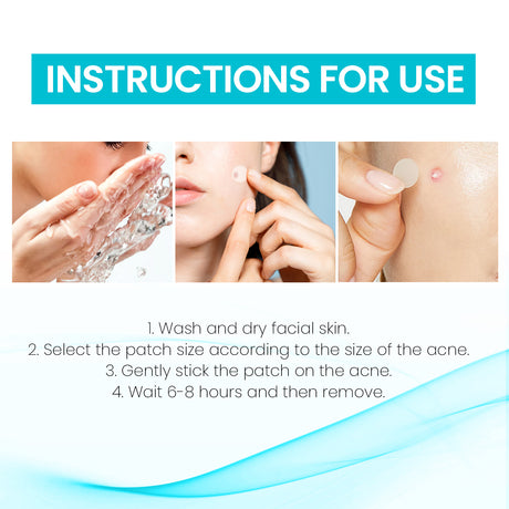 Acne Patch, Repair Facial Acne Invisible Concealer Hydrocolloid Patch - V.I.P Digital Presence