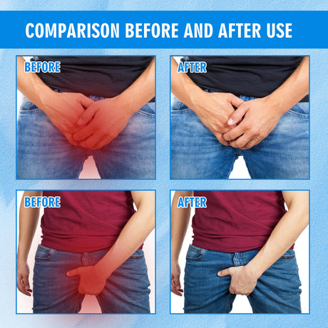 Men's Skin Care Cream For Inner Thigh Itching Relief Refreshing And Gentle Skin Cream - V.I.P Digital Presence