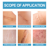 Scar Repair Serum Lightens Post-Pregnancy Scar Repair And Smoothes Body Skin - V.I.P Digital Presence