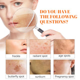 Papaya Whitening Freckle Cream Lightens Dark Spots On The Face, Brightens And Moisturizes The Skin Early And Late - V.I.P Digital Presence