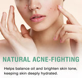 Green Tea Moisturizing Toner, Skin Tender Shine Clean Blain Mark Clear Water Not Greasy Toner - V.I.P Digital Presence