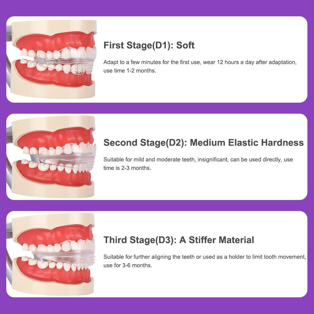 Transparent braces, exercise braces, orthodontic treatment for adults, shape retention correction, night wear prevention - V.I.P Digital Presence