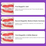 Transparent braces, exercise braces, orthodontic treatment for adults, shape retention correction, night wear prevention - V.I.P Digital Presence