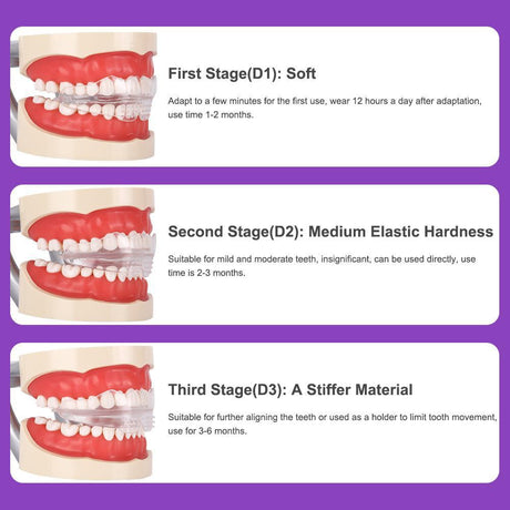 Transparent braces, exercise braces, orthodontic treatment for adults, shape retention correction, night wear prevention - V.I.P Digital Presence