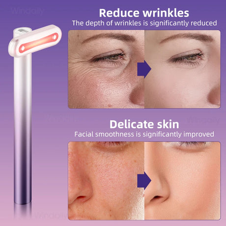 4 in 1 Facial Wand EMS Microcurrent Vibration Warm Red Light Face Lifting Machine Skin Tightening Device Neck Eye Massager Tools - V.I.P Digital Presence