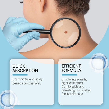 Keyu Liquid Hand And Foot Skin Especially Moles Cleansing Repair Smooth Skin Skin Label Care Liquid - V.I.P Digital Presence