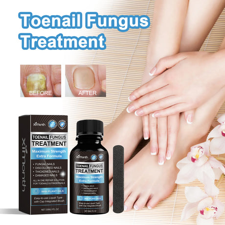 Toenail Fungus Treatment, Repair The Brotherhood Of Nails Rotten Jiasheng Mail This Soft Armour A Detailer - V.I.P Digital Presence