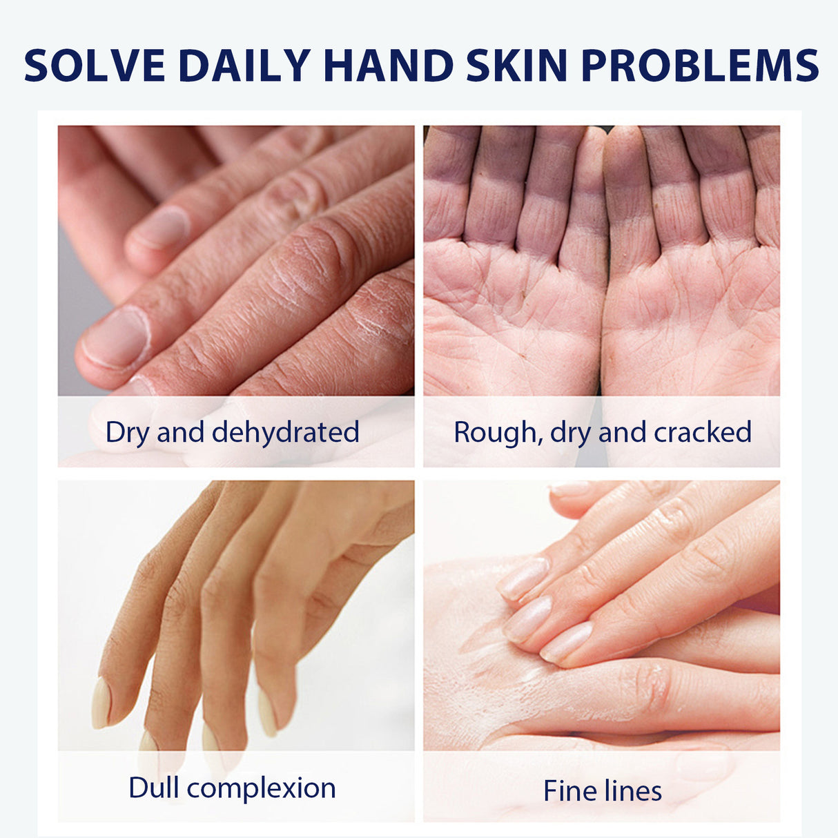 Aloe Vera Care Gel, Hydrating And Refreshing Moisturizing Cream Prevents Dryness And Cracks To Repair Hand Skin - V.I.P Digital Presence