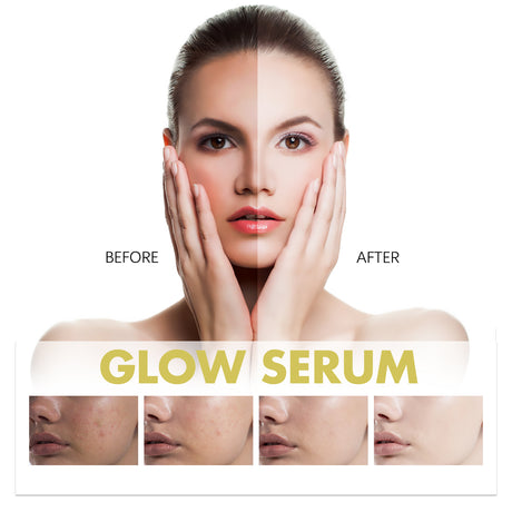 Glow Serum, Moisturizing And Whitening Skin To Reduce Facial Spots And Fine Lines - V.I.P Digital Presence