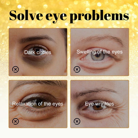 24K Gold Anti-Wrinkle Eye Mask, Moisturizing And Improving Eye Lines Brightening And Moisturizing Eye Skin Eye Care - V.I.P Digital Presence