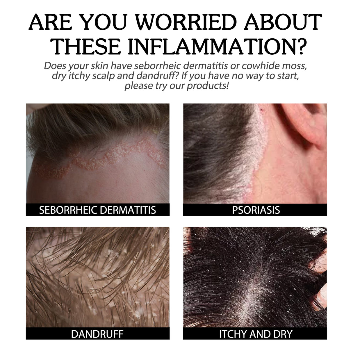 Cowhide Moss Repair Spray Relieves Redness And Itchy Scalp Skin Repair Spray - V.I.P Digital Presence