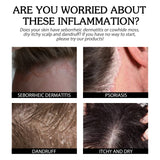 Cowhide Moss Repair Spray Relieves Redness And Itchy Scalp Skin Repair Spray - V.I.P Digital Presence