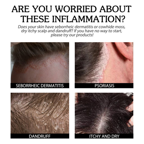 Cowhide Moss Repair Spray Relieves Redness And Itchy Scalp Skin Repair Spray - V.I.P Digital Presence