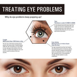 Retinol Eye Cream, Desalination Smoothen Fine Lines Eye Pouch Black Rim Of The Eye Moist Nursing Play Tight Muscle Eye Cream - V.I.P Digital Presence