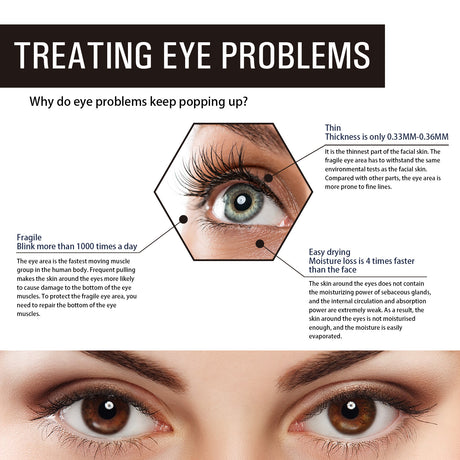 Retinol Eye Cream, Desalination Smoothen Fine Lines Eye Pouch Black Rim Of The Eye Moist Nursing Play Tight Muscle Eye Cream - V.I.P Digital Presence