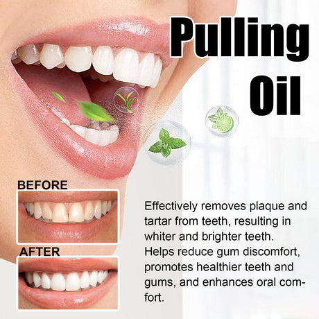 Puling Oil, Clean Mouth Odor Tartar Very Well Protect Teeth And Fresh Breath - V.I.P Digital Presence