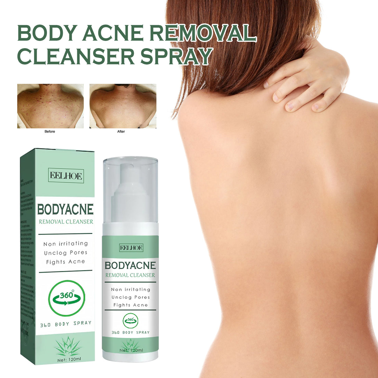 Body Acne Removal Cleanser Spray, Deep Clean Back Arm Fade Acne Beauty Moisturizing Spray - V.I.P Digital Presence