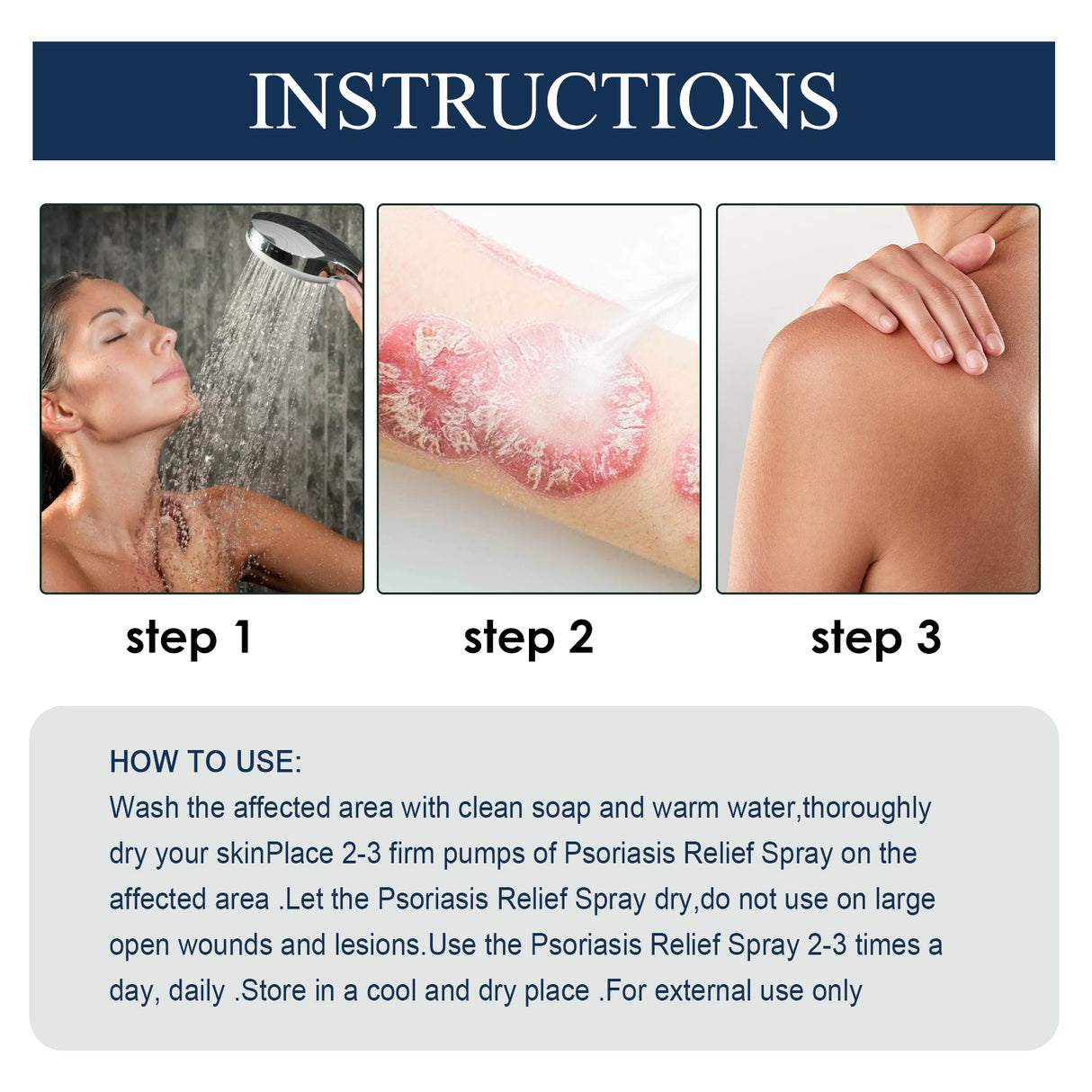 Psoriasis Relief Spray, Relieve Skin, Hands And Feet Redness Peeling Itch Repair External Care - V.I.P Digital Presence