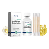 Anti-Pimple Drying Lotion, Facial Cleansing And Repair Lighten Acne Marks And Pits, Close Your Mouth And Mild Skin Cream - V.I.P Digital Presence