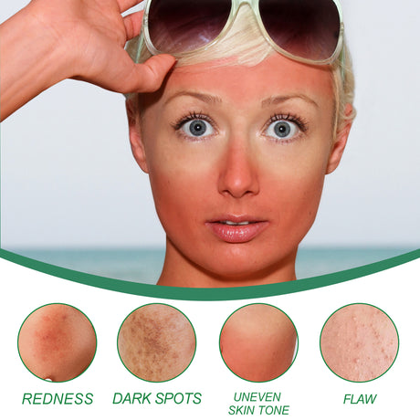 Color Correction Treatment Cream, Lighten Spots After Sun Repair Moisturizing Skin Beauty Cream - V.I.P Digital Presence