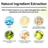 Herbal Acne Serum, Reduce Acne Pimples With A Comprehensive Moisturizing Moisturizer - V.I.P Digital Presence