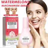Watermelons Niacinamide Serum, Dilute Spots Firming Haun White Skin Hydrating Moisture Essence - V.I.P Digital Presence