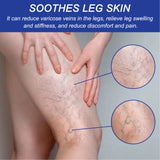 Vein Comfort Spray, Relief Leg Muscle Soreness And Swelling Earthworm Leg Vein Treatment Spray - V.I.P Digital Presence