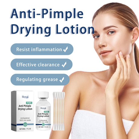 Anti-Pimple Drying Lotion, Facial Cleansing And Repair Lighten Acne Marks And Pits, Close Your Mouth And Mild Skin Cream - V.I.P Digital Presence