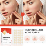 Hydrocolloid Acne Patch Face Invisible Makeup Closed Mouth Acne Clear Acne Waterproof Breathable Facial Treatment - V.I.P Digital Presence