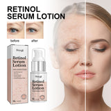 Retinol Serum Lotion, Fade Out Fine Lines Filling Water Moisturizing Anti-Wrinkle Firming Facial Skin Aging - V.I.P Digital Presence