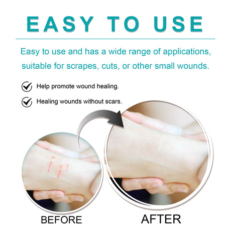 Liquid Bandage Drops Protect Skin Fast Film Formation Breathable Waterproof Skin Repair Drops - V.I.P Digital Presence