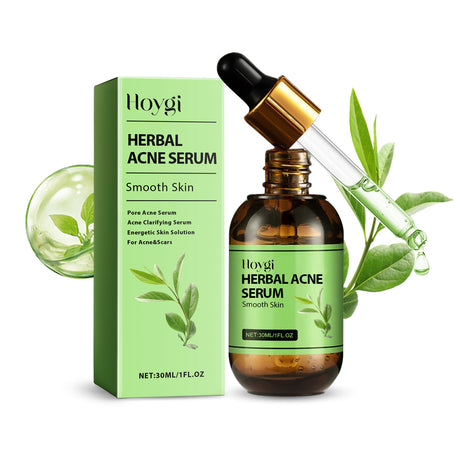 Herbal Acne Serum, Reduce Acne Pimples With A Comprehensive Moisturizing Moisturizer - V.I.P Digital Presence