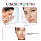 Salicylic Acid Acne Drying Lotion, Gentle Repair Acne-Skin Skin Moisturizing Lotion - V.I.P Digital Presence