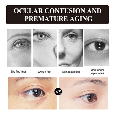 Retinol Eye Cream, Desalination Smoothen Fine Lines Eye Pouch Black Rim Of The Eye Moist Nursing Play Tight Muscle Eye Cream - V.I.P Digital Presence