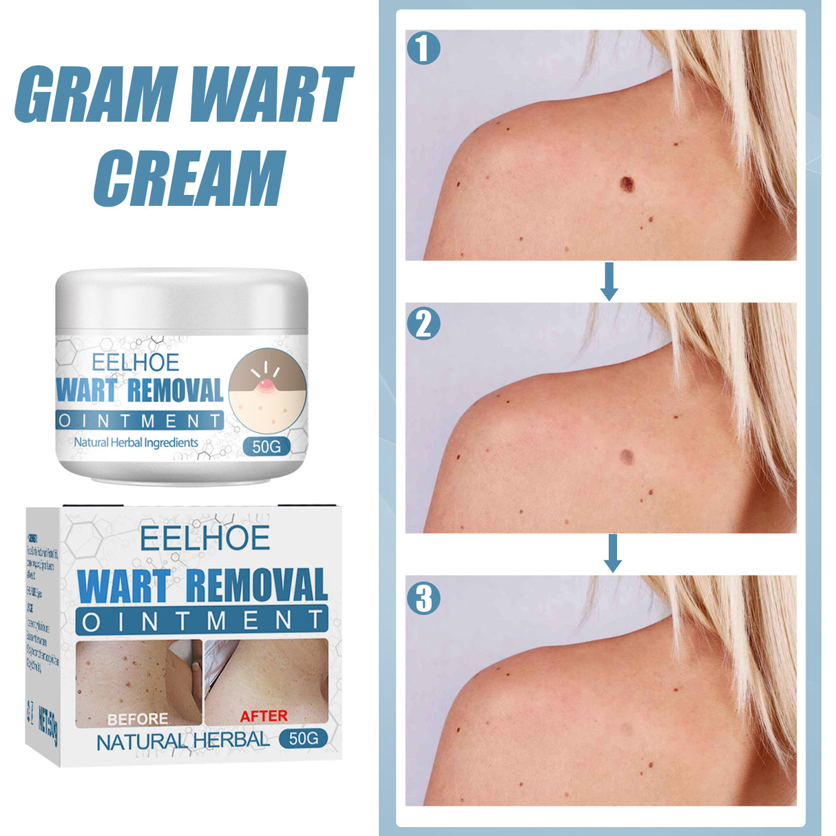 Wart Cream, Skin Clean And Smooth Wart Nevi Facial Care Cream - V.I.P Digital Presence
