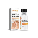 Anti-wart Essence, Anti Warts Fade Moles Corns Smoothing Skin Care Essence - V.I.P Digital Presence