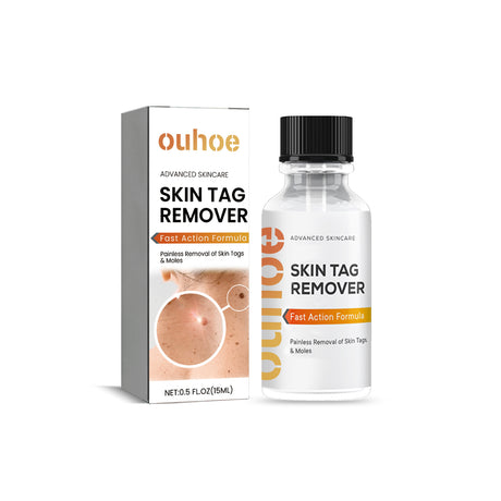 Anti-wart Essence, Anti Warts Fade Moles Corns Smoothing Skin Care Essence - V.I.P Digital Presence