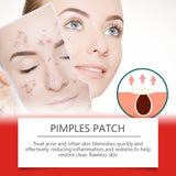 Morning And Evening Acne Covering Patch Facial Skin Acne Covering Relief Care Skin Acne Muscle