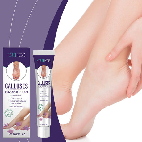 Foot Callous Removal Repair Cream Gently Softers Exfoliation Soothing Dry Moisturizing Hydrating Repair Cream - V.I.P Digital Presence