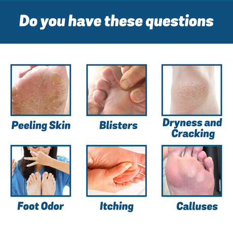 Medical Nail Fungus Foot Spray, Repair Thickening Gray Nail Rot Foot Moisturizing And Cleansing Armor - V.I.P Digital Presence