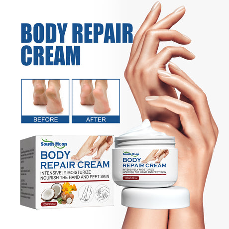 Body Repair Cream, Relieve Peeling Improve Chapped Dry Skin And Remove Dead Skin Moisturize Cream - V.I.P Digital Presence