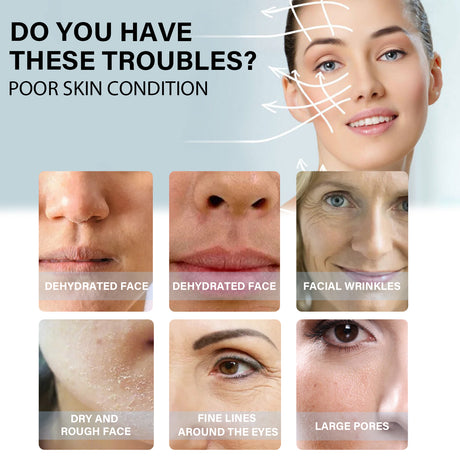 Protein Ascending Line, Skin Lift Anti-Wrinkle V Face Lift Relaxes Facial Contours And Moisturize Line - V.I.P Digital Presence