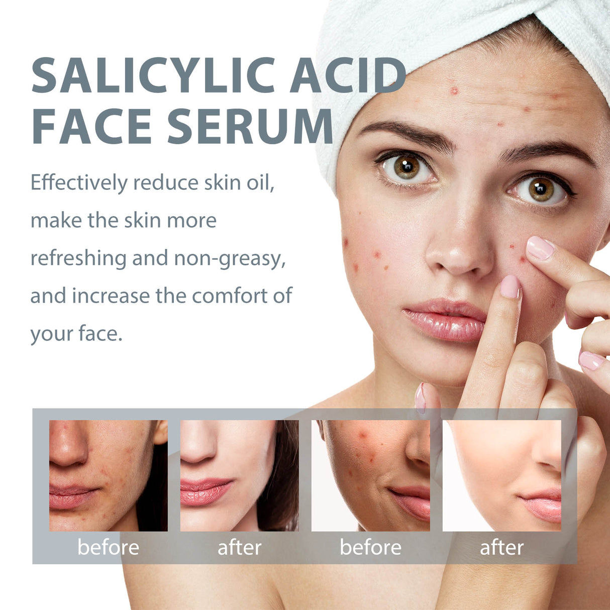 Salicylic Acid Facial Essence, Lighten Acne Mark Repair Hydrating Facial Care Essence - V.I.P Digital Presence