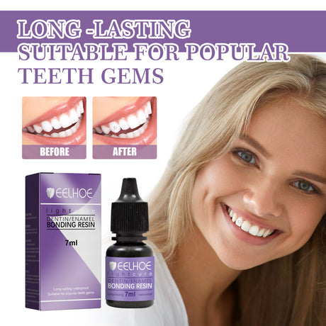 Tooth Gem Decorative Glue, DIY Fashionable Jewelry Bonding Teeth Gems Light Cured Adhesive Glue - V.I.P Digital Presence
