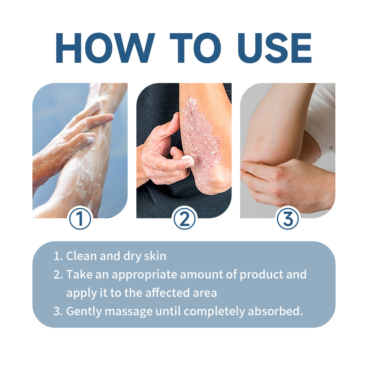 Moisturizing Cream, Moisturizing And Repairing Skin Care Cream For Itchy And Swollen Skin - V.I.P Digital Presence