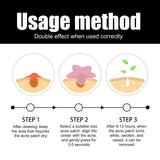 Acne Removal Protection Defense Patch, Color Profile-shaped Portable Invisible Cover Acne Patch - V.I.P Digital Presence