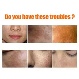 Turmeric Skin Care Series Deeply Cleans And Repairs Skin Barrier, Hydrates And Moisturizes White And Supple Skin