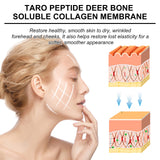 Collagen Membrane, Reduces Wrinkles, Smooths Forehead Fine Lines, Moisturizes And Tightens Skin Protein Membrane