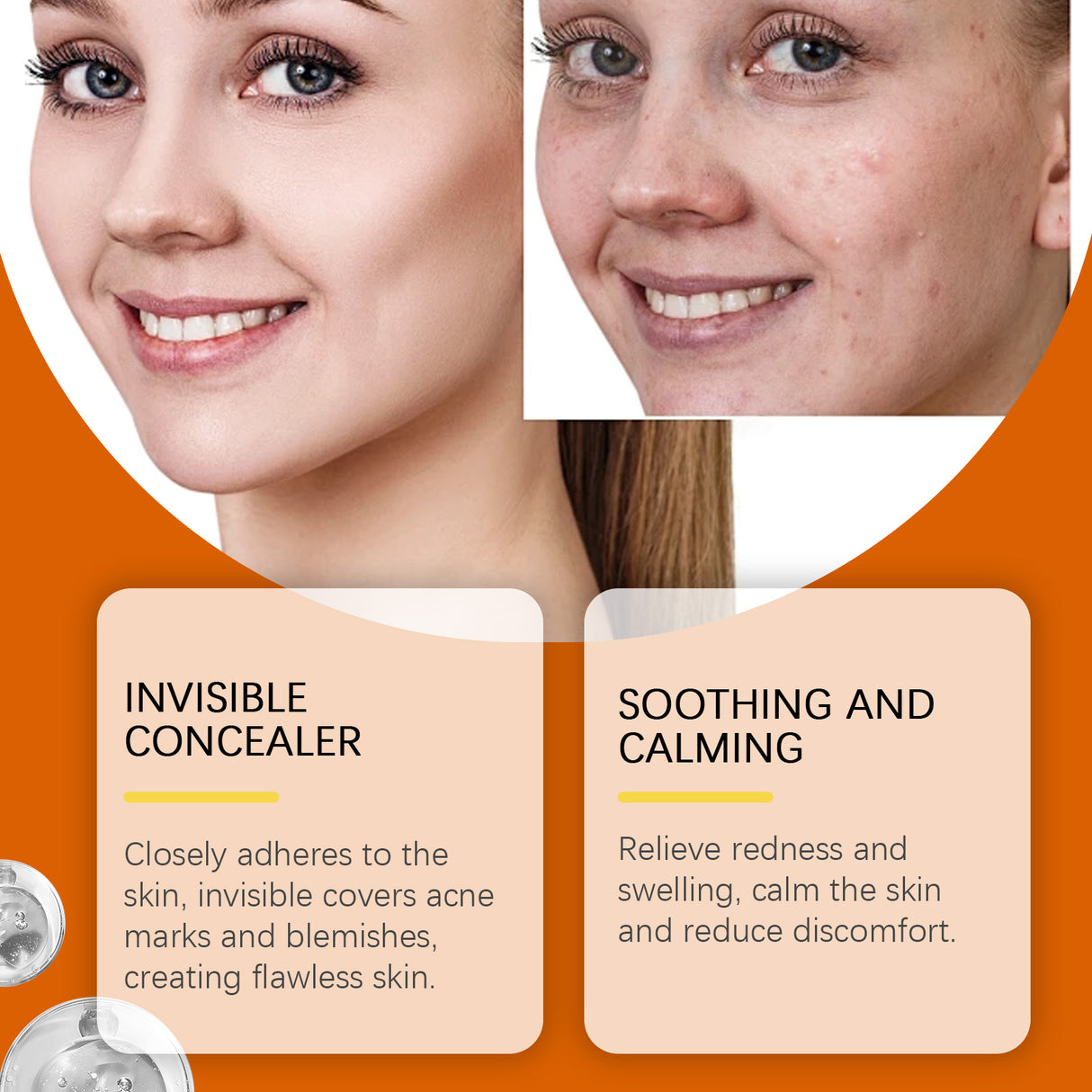 Facial Acne Patch, Repair Facial Acne Acne Facial Skin Care To Remove Facial Acne