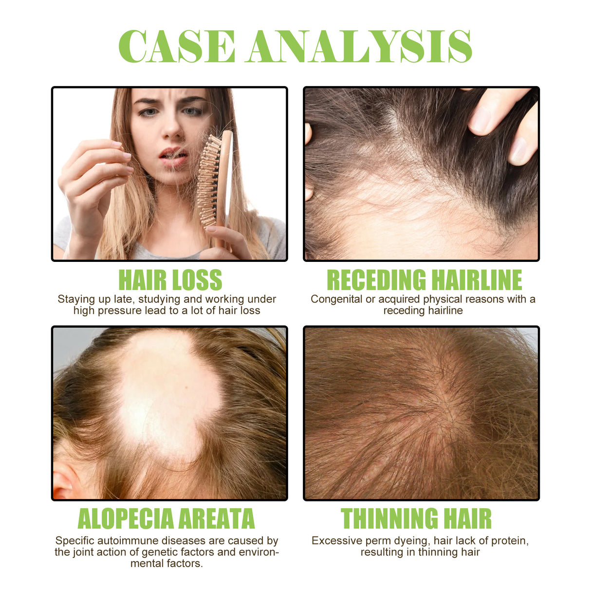 Ginger Care Shampoo Scalp Cleansing, Anti-Break Nourishing Root Strengthening Shampoo - V.I.P Digital Presence